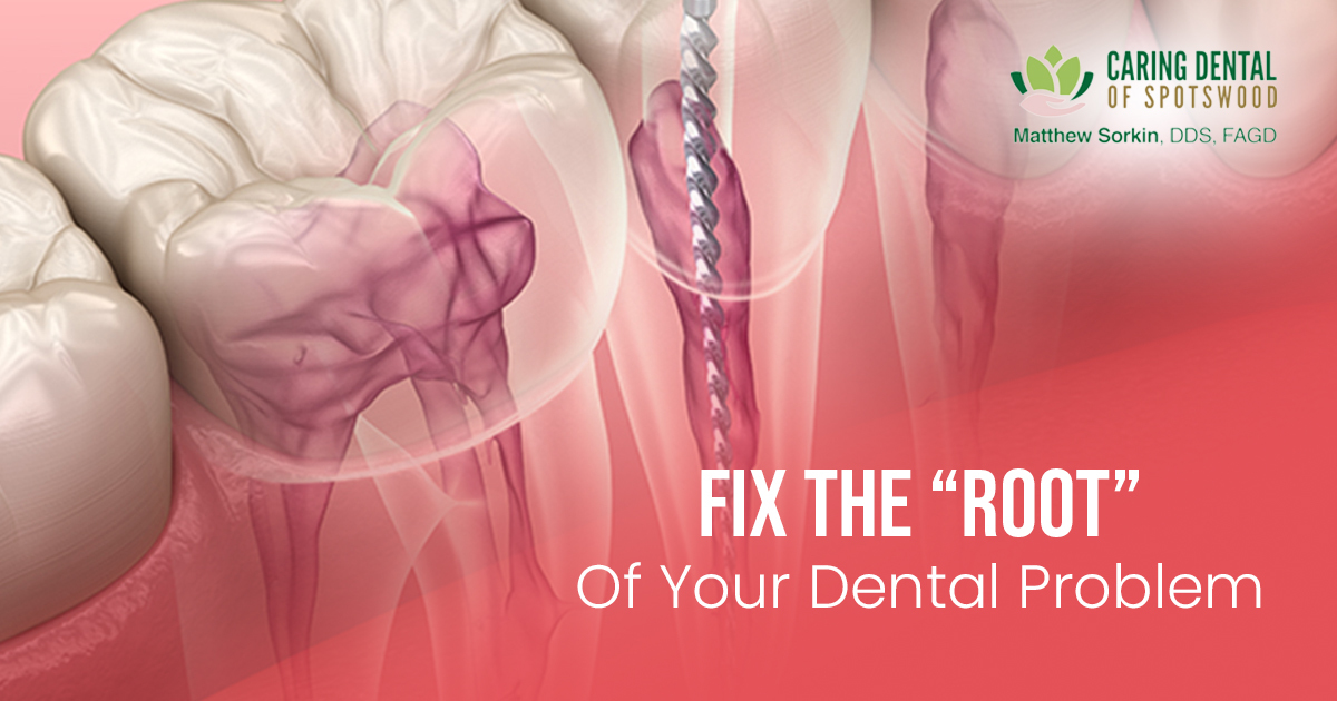 Blog – sorkin- Fix the root of your dental problem – 1200 x 630