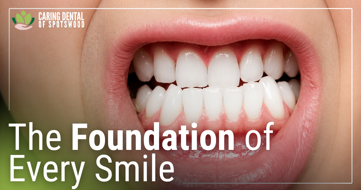 person showing full bite with white teeth