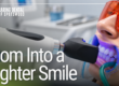 female patient undergoing teeth whitening treatment